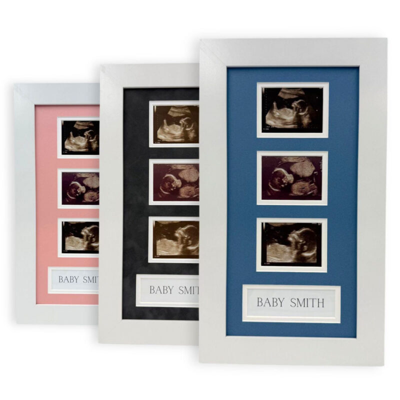 Baby Scan Frame